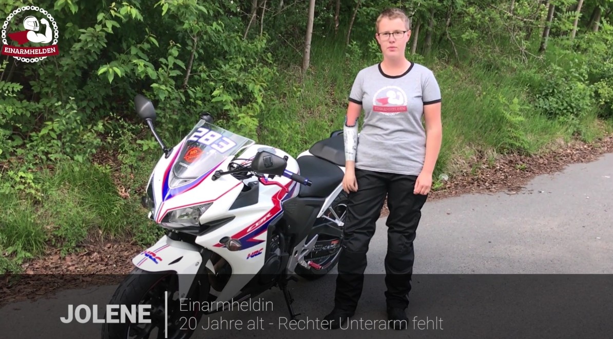 Einarmheldin Jolene – Ihr fehlt der rechte Unterarm
